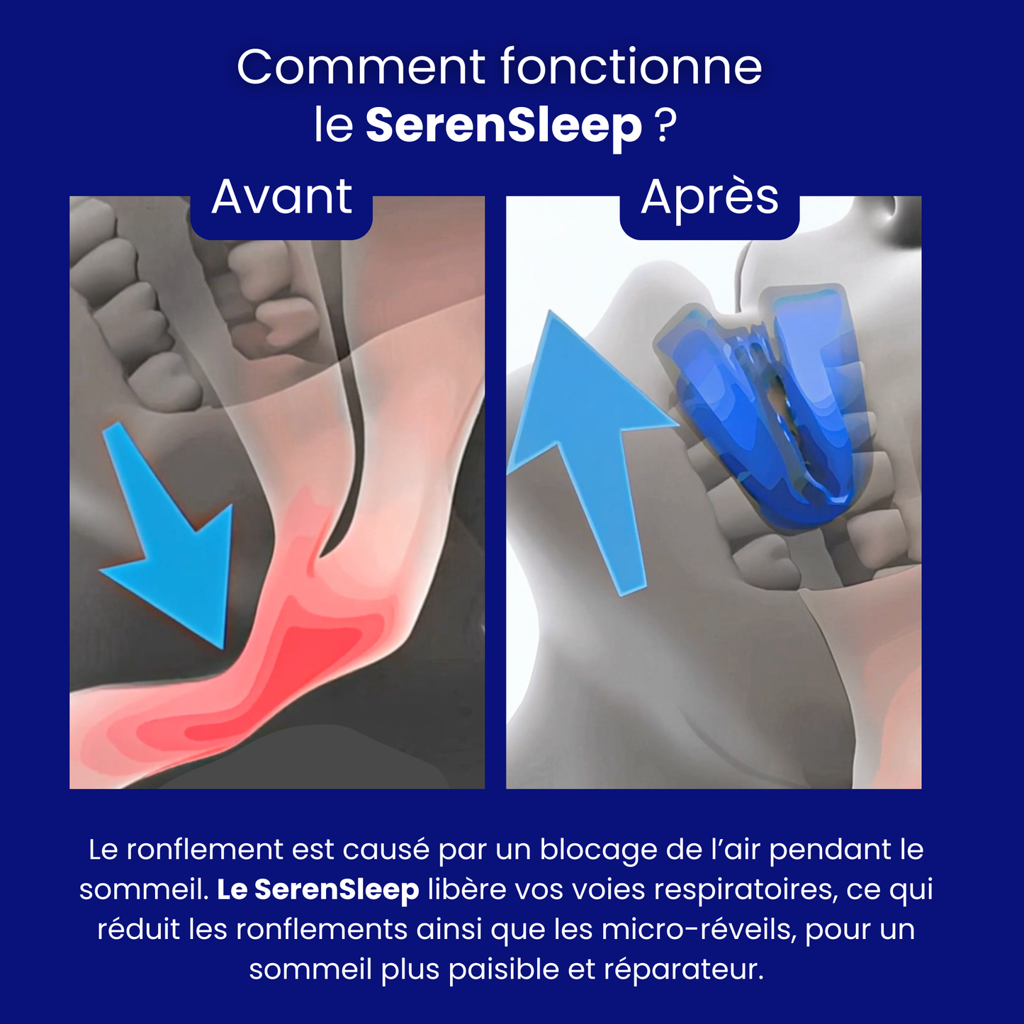 SerenSleep™ - dormez en silence